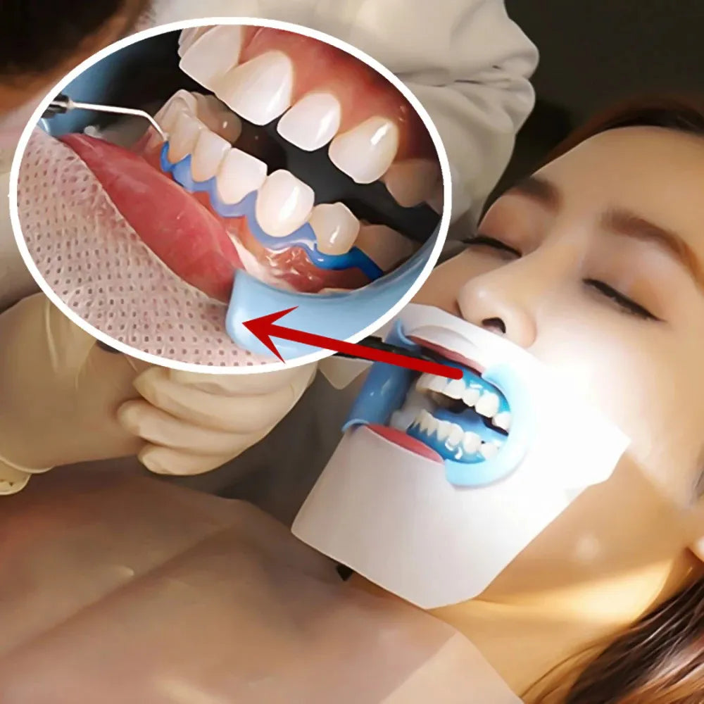 Prevest Gingiva Shield Vlc