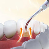 Woodpecker Scaler Tips for DTE & Satelec Scalers