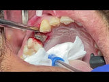 GDC Root Elevators Warwick James - Straight (Ewjs)