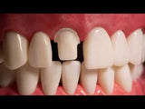 API Typodont Teeth Set with Screw