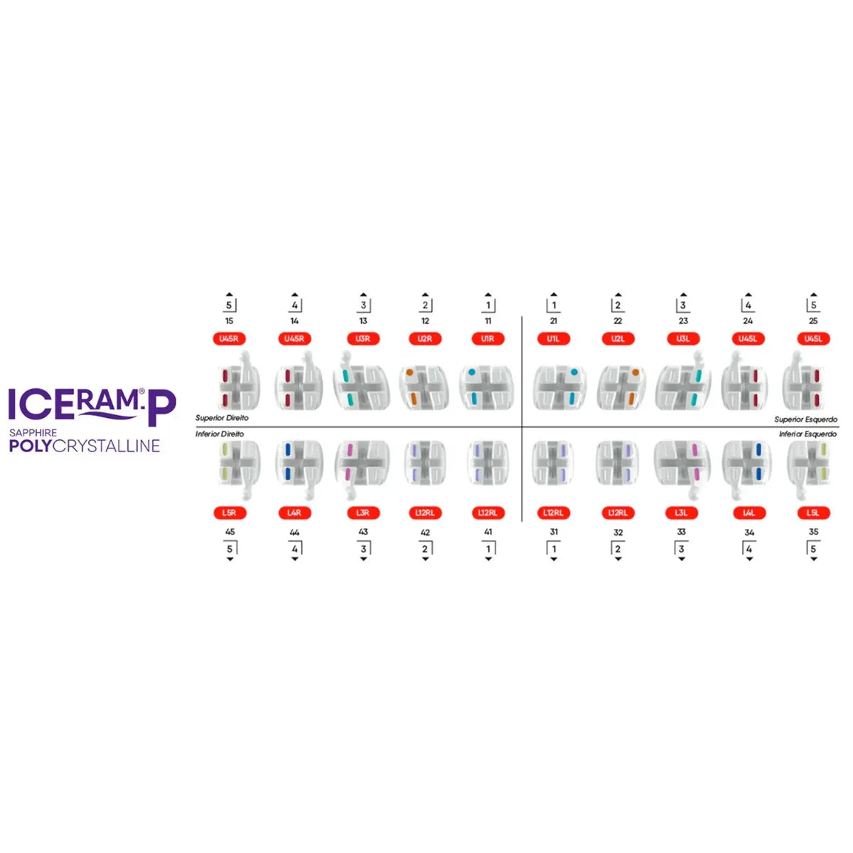 OrthoMetric Iceram - P Polycrystalline Ceramic Bracket Kit