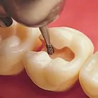 Mani Diamond Burs - Si Series