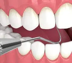 Api Dental D/E Probe