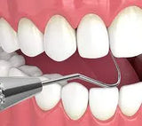 Api Dental D/E Probe