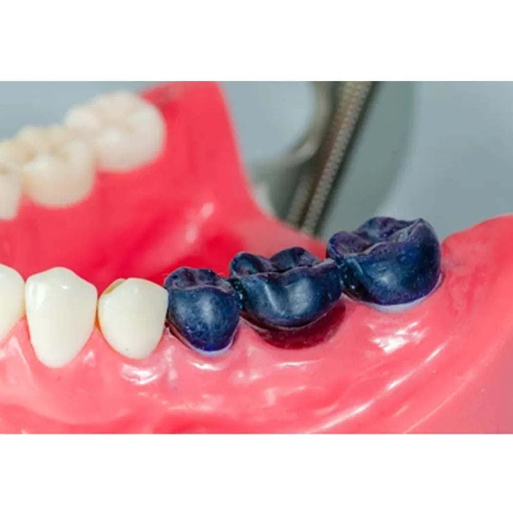 Eva Wax Inlay Maarc Inlay/Onlay Wax Sticks – Dentaid Devices