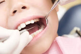 Api Dental D/E Probe