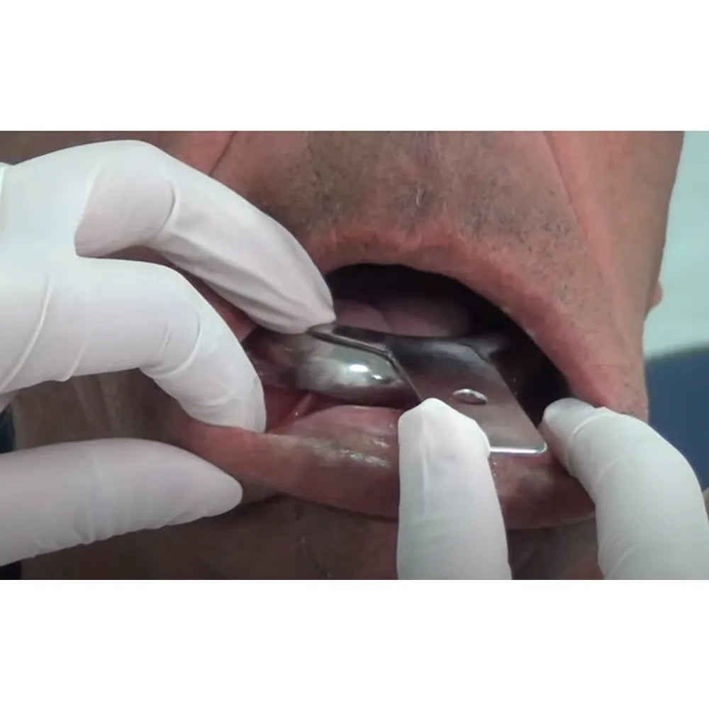 GDC Edentulous Non-Perforated Impression Trays Lower # 1 (ITRLEDNPL1)