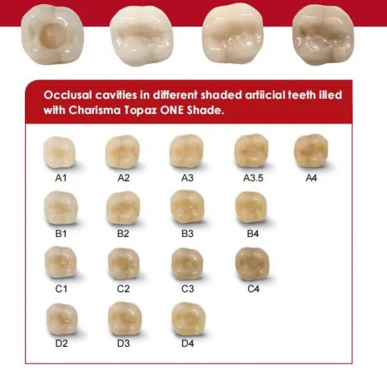 Kulzer Charisma Topaz One Shade Resin Based Restorative Composite Kit