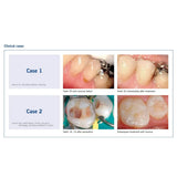 Voco Ionolux Glass Ionomer Restorative Cement