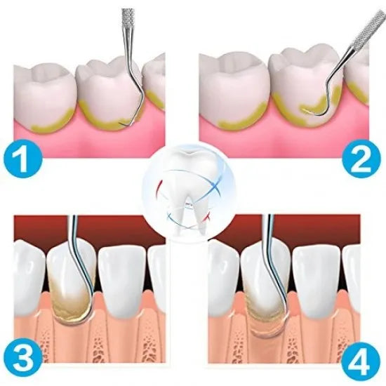 GDC Manipal Scaler Set Of 3 Pcs Instruments Kit (MS3)