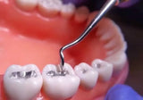 Dpi Fine Grain Dental Silver Alloy