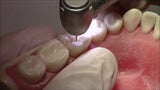 API Typodont Teeth Set with Screw