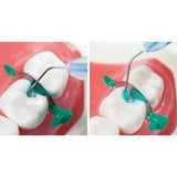 Prevest Denpro Microgel SF