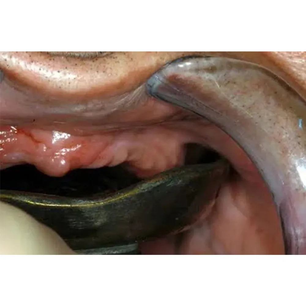 GDC Edentulous Non-Perforated Impression Trays Upper #2 (ITRLEDNPU2)