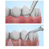 Woodpecker Scaler Tip PD1 for DTE & Satelec Scalers
