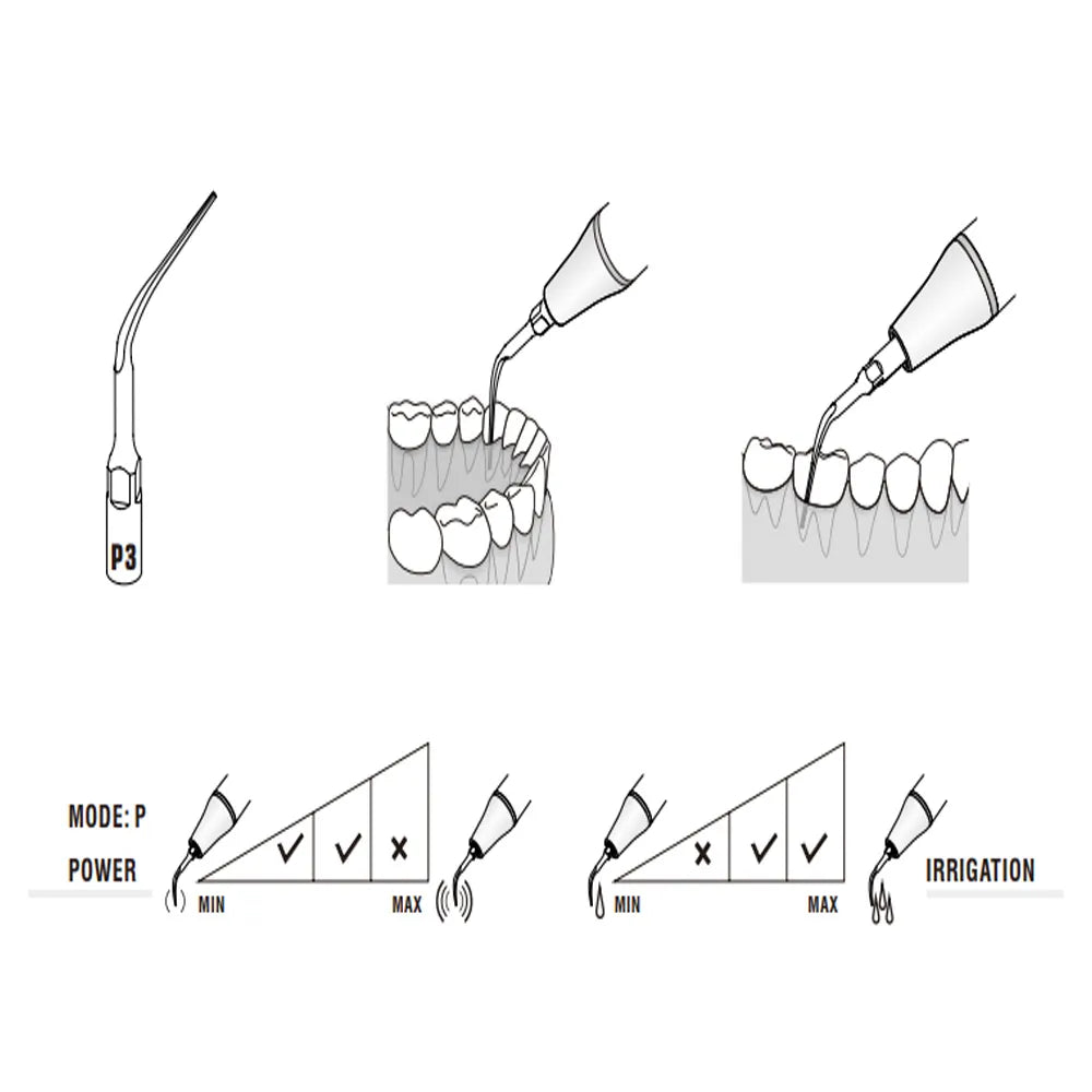 Woodpecker Scaler Tip P3 for UDS & EMS Scalers