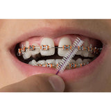 D-Tech Precimax (MIM MBT Prescription Brackets)