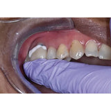 3m Espe Relyx Temp Non Eugenol