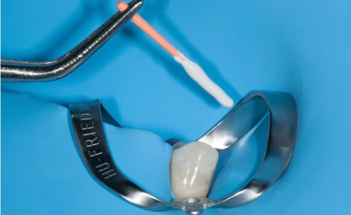 SafeEndo EpoxySeal