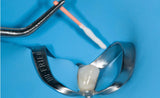 SafeEndo EpoxySeal