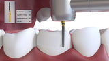 Coltene Diatech Inlay & Crown Preparation Kit (250006AA)