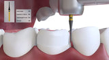 Coltene Diatech Inlay & Crown Preparation Kit (250006AA)