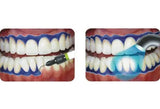 Prevest Gingiva Shield Vlc