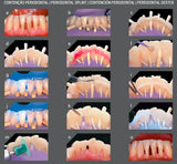 Angelus Interlig Single Patient Strip