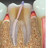 Dentsply Ah Plus Root Canal Sealant