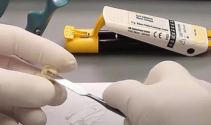 3m Espe Relyx U200 Self-Adhesive Resin Cement