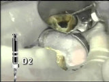 Dentsply Protaper Universal Retreatment Rotary Files