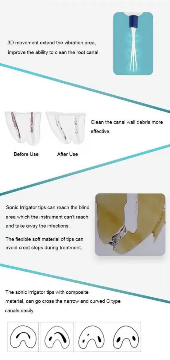 API Sonic Endo Irrigator (60 Tips Free)