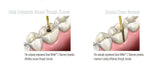 Great WhiteZ Introductory Kit