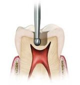 Ss White Surgical Length Carbide Fg Burs