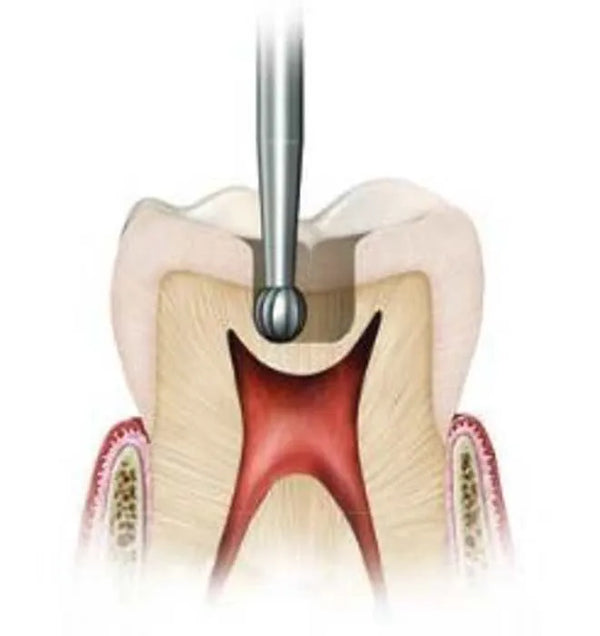 Ss White Surgical Length Carbide Fg Burs