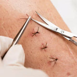Api Scissors Heath For Suture Cutting (15.5cm) (S25)