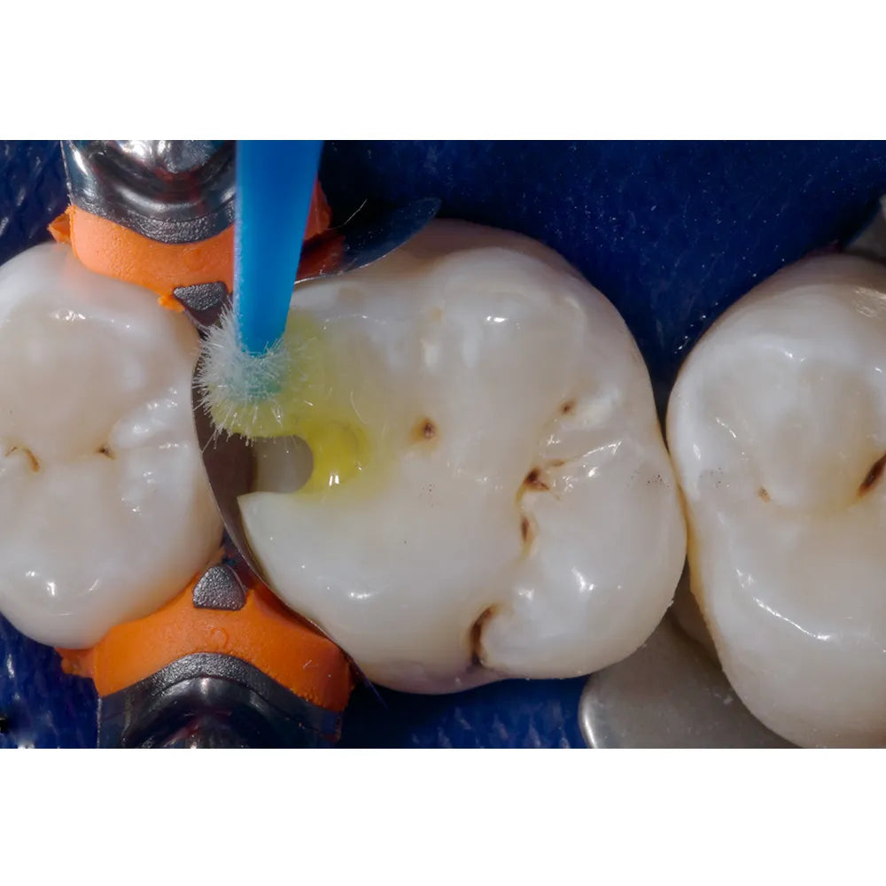 Ivoclar Vivadent Te-Econom Bonding Agent