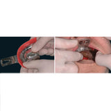 GDC Impression Trays Edentulous Perforated S/8 Instruments Kit (ITRLEDPP8)