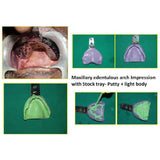 GDC Impression Trays Edentulous Perforated S/8 Instruments Kit (ITRLEDPP8)