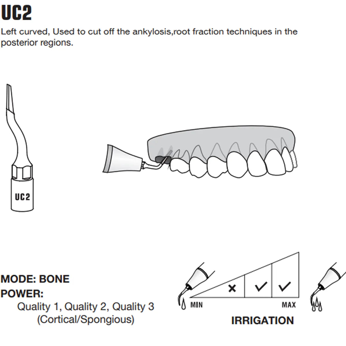 Woodpecker Piezo Bone Surgery Tips