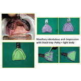 Mani Diamond Burs - Di Series