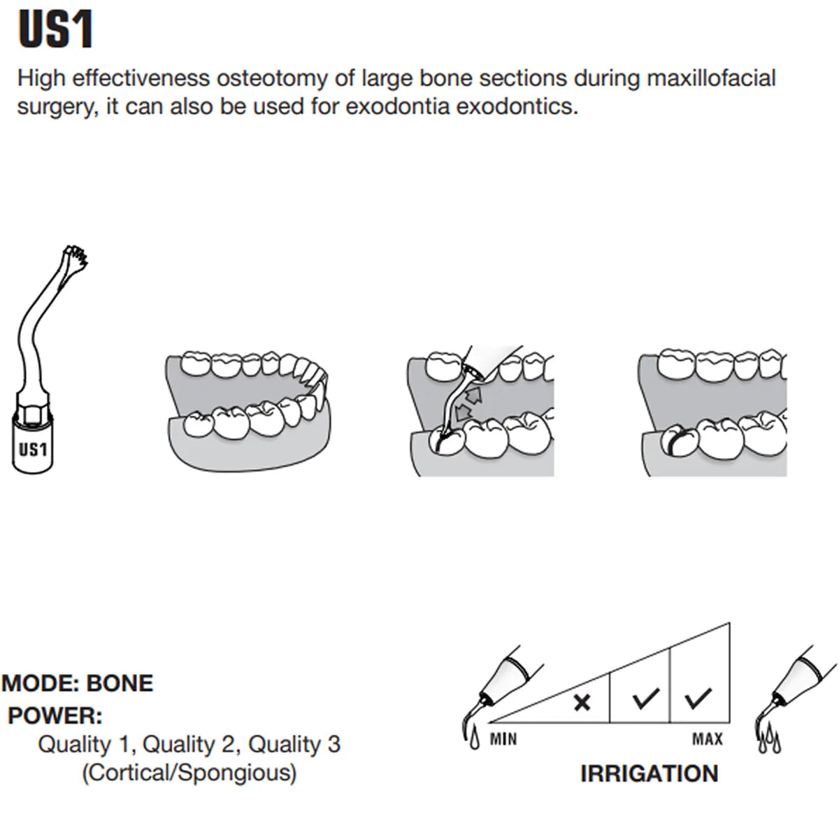 Woodpecker Piezo Bone Surgery Tips