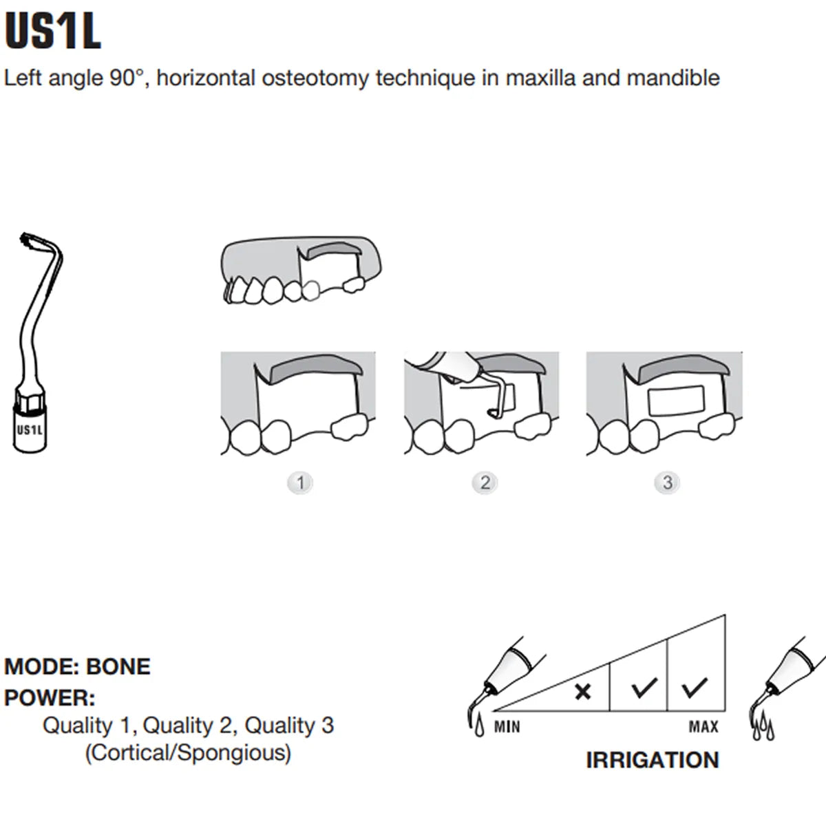 Woodpecker Piezo Bone Surgery Tips
