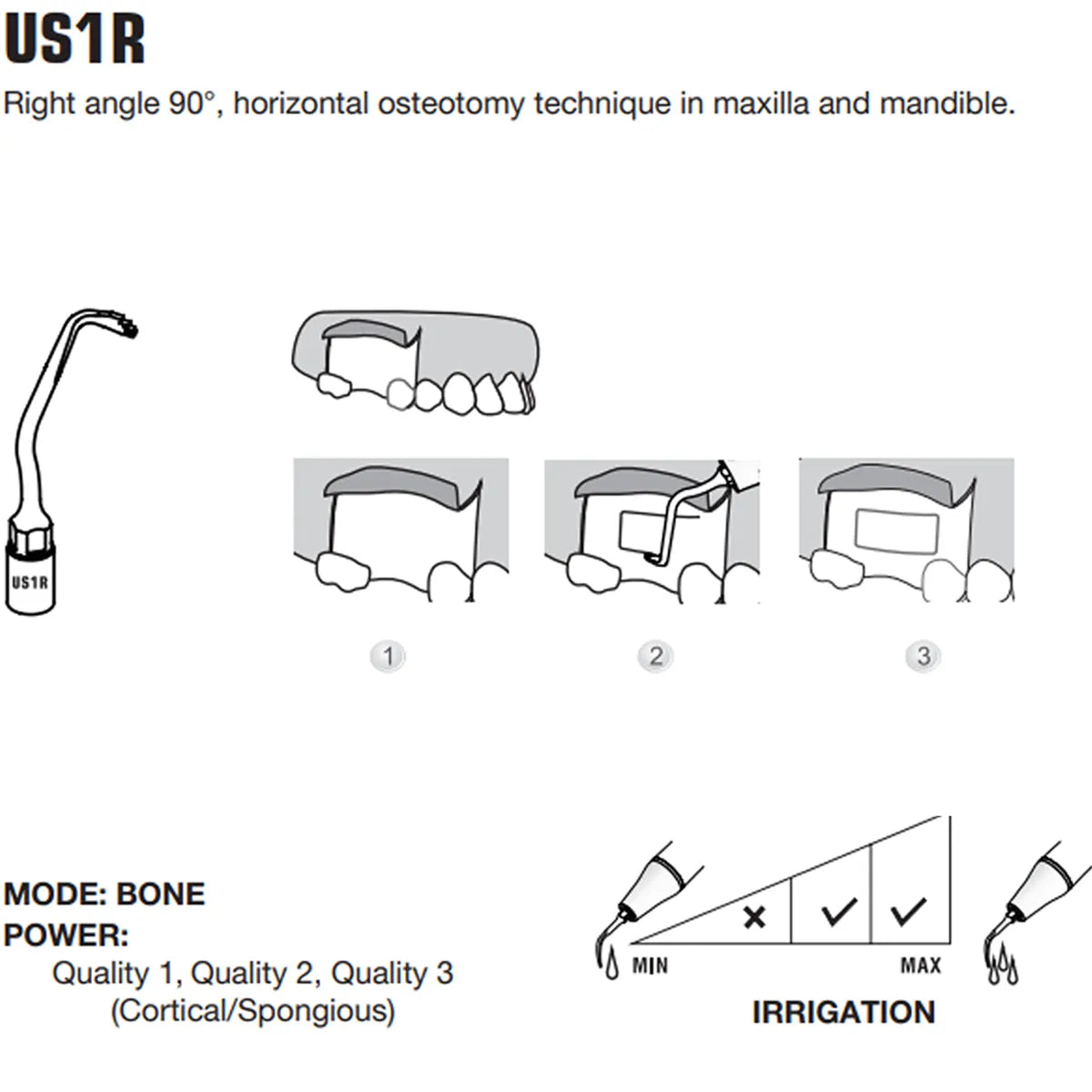 Woodpecker Piezo Bone Surgery Tips