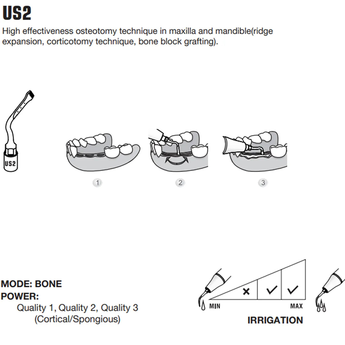 Woodpecker Piezo Bone Surgery Tips