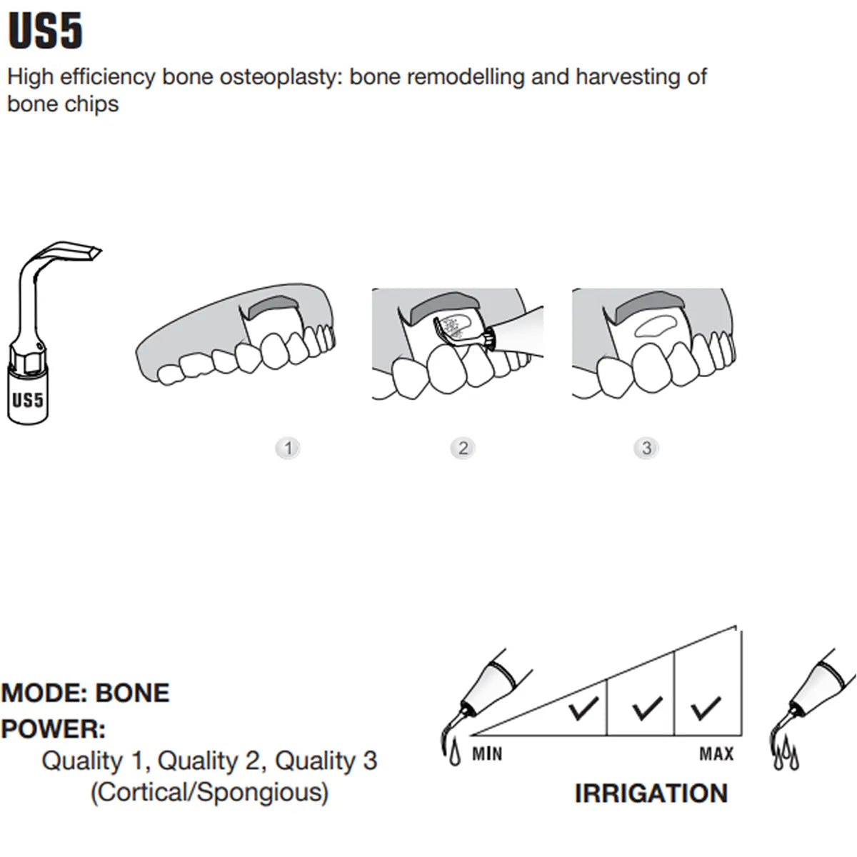 Woodpecker Piezo Bone Surgery Tips